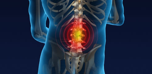 Vertebral Compression - Los Angeles Pain Specialist